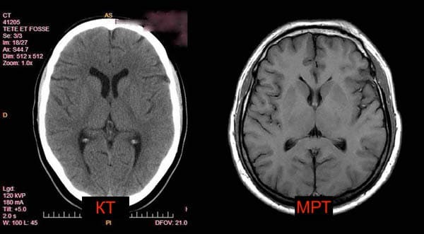 МРТ и КТ головного мозга